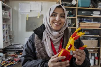 An adult shows off a prosthetic hand in jordan.